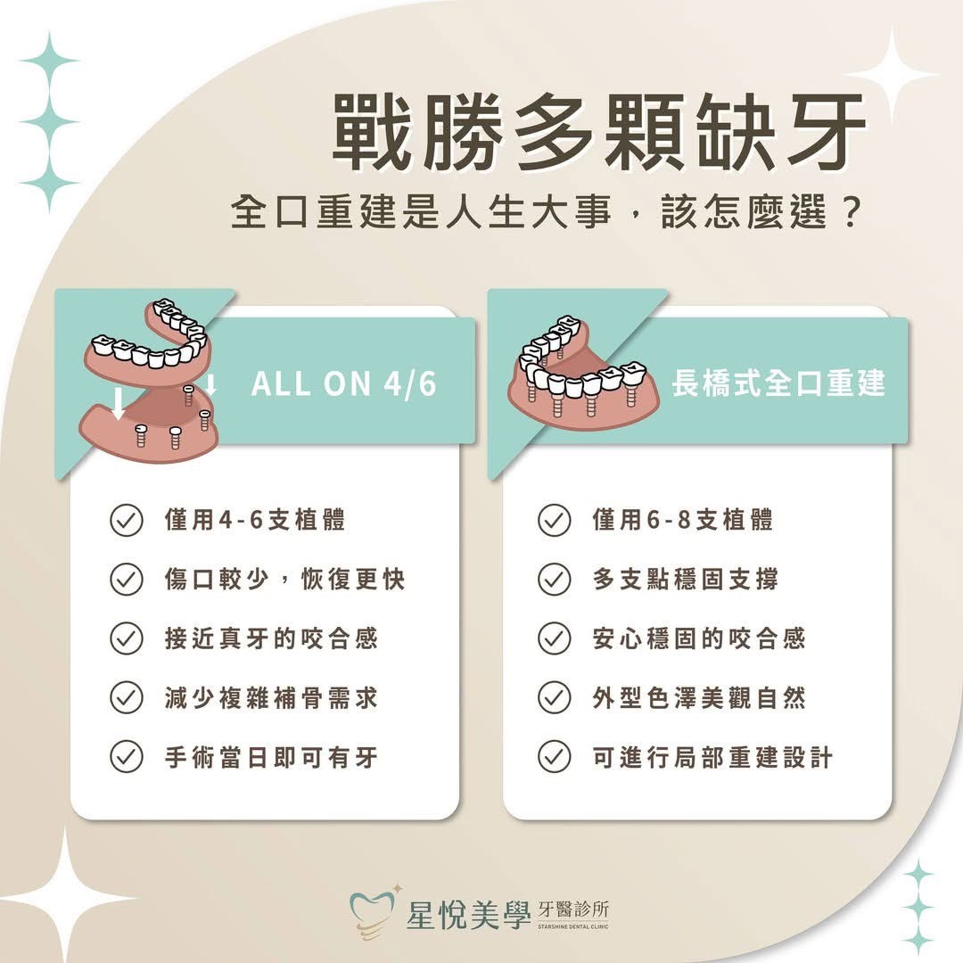 植牙全口重建比較