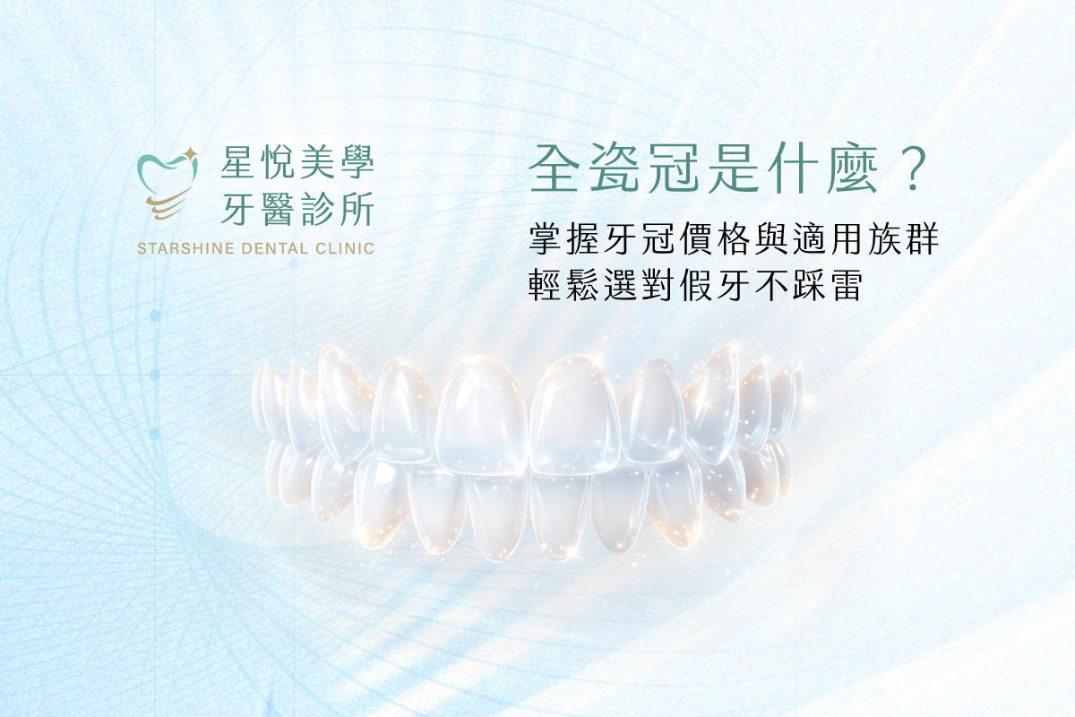 全瓷冠是什麼?掌握牙冠價格與適用族群,輕鬆選對假牙不踩雷!