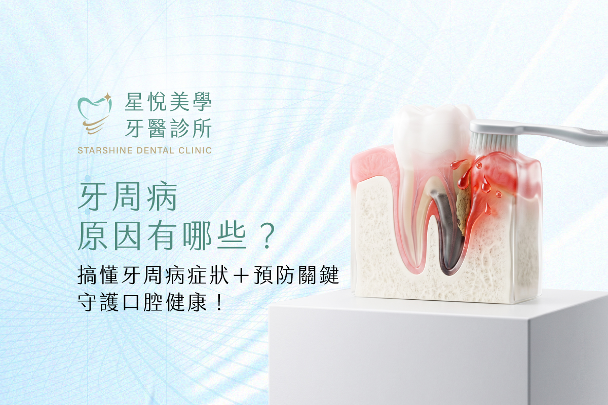 牙周病原因有哪些？搞懂牙周病症狀＋預防關鍵，守護口腔健康！