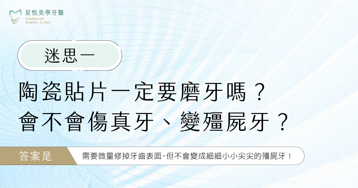 迷思一: 陶瓷貼片一定要磨牙嗎?會不會傷真牙、變殭屍牙?
