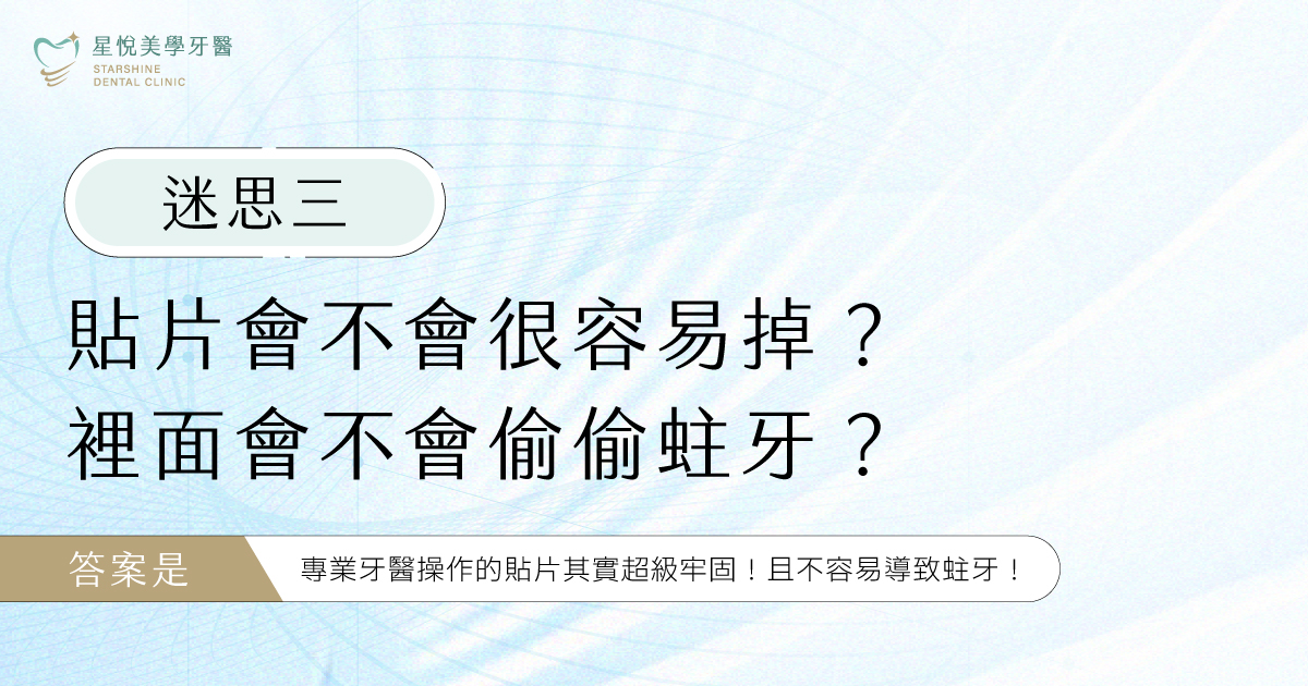 迷思三:貼片會不會很容易掉?裡面會不會偷偷蛀牙?答案是:專業牙醫操作的貼片穩固性通常良好,且不容易導致蛀牙。牙醫使用的黏著技術效果不錯,只要避免用牙齒去啃特別堅硬的物品,貼片基本上能與真牙緊密貼合,不易鬆動。那為什麼有人做完會蛀牙?這通常有兩個原因:第一,是找了坊間沒有執照的「非法美容坊」做便宜貼片,導致貼片跟牙齒之間有縫隙,細菌跑進去。第二,是做完貼片後自己不好好刷牙、不用牙線。只要找對專業牙醫,並且保持良好的潔牙習慣,蛀牙的機會可以降到很低 。