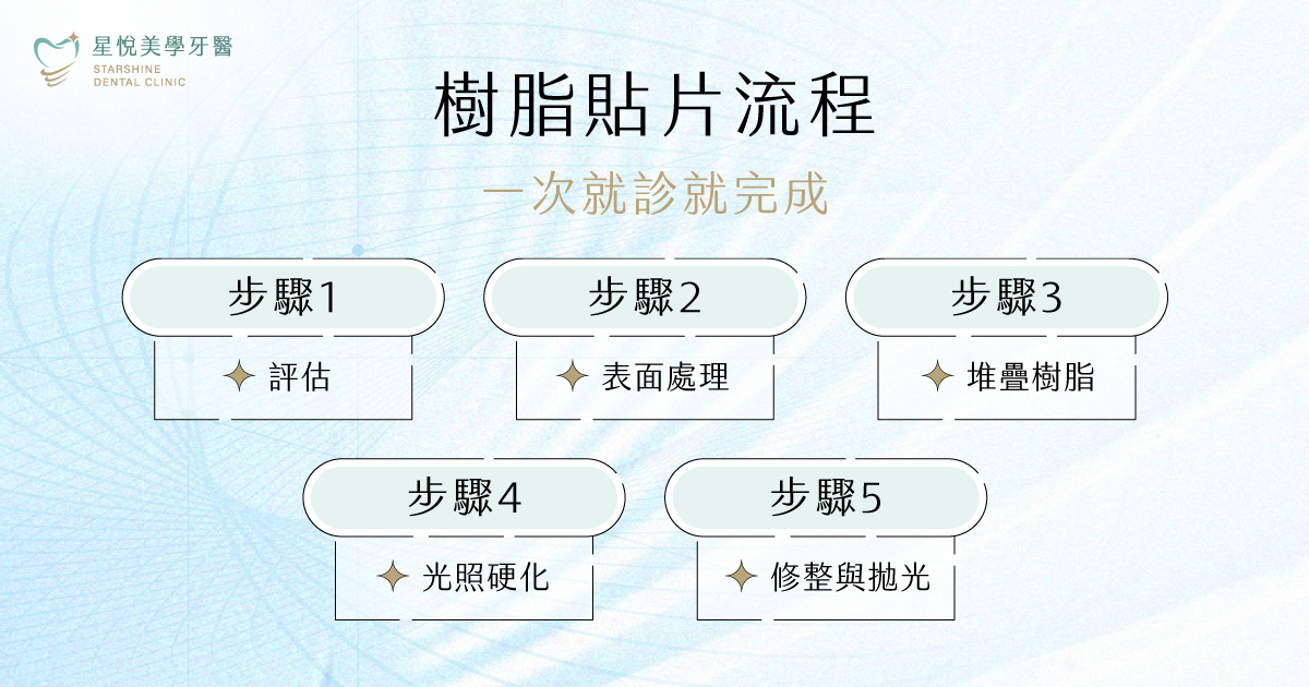 樹脂貼片當日完成流程圖:評估選色、表面處理堆疊、光照硬化、修整拋光