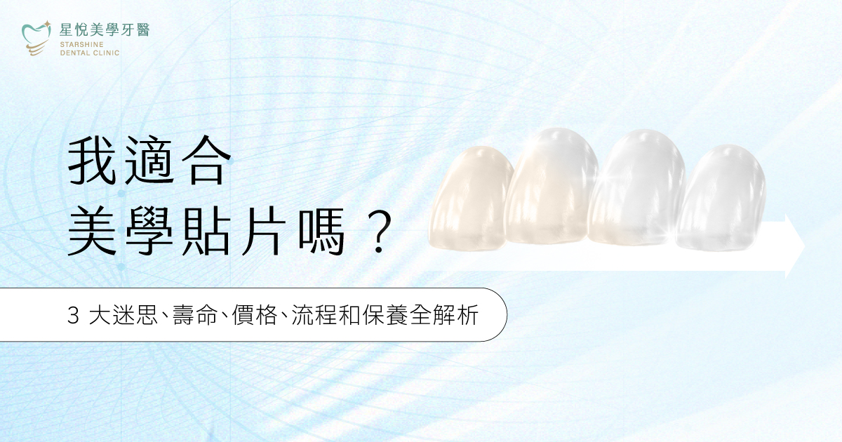 美學貼片適合你嗎？台中星悅美學牙醫審閱，完整解析陶瓷、鋯白、樹脂三大貼片材質差異、價格、壽命與保養方式，並破解磨牙、敏感、蛀牙三大迷思，立即了解自己適合哪一種貼片。
